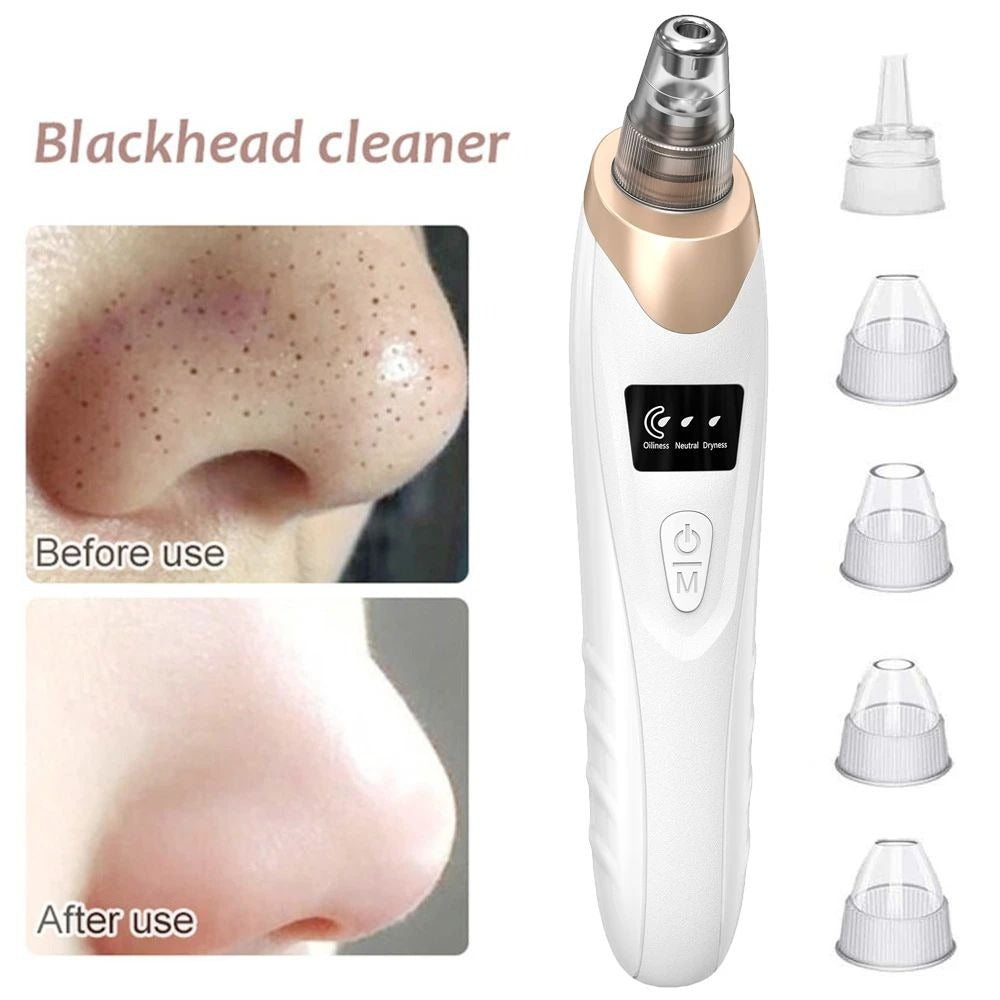 Blackhead Remover Vacuum – 5-in-1 Facial Tool